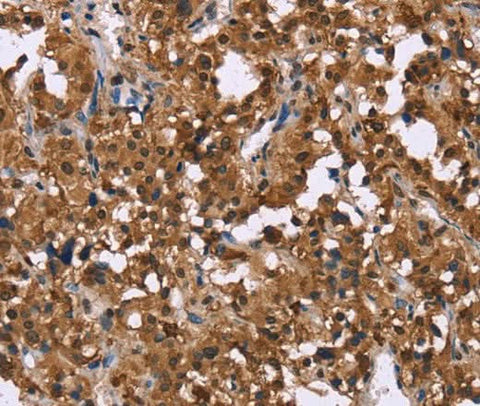 Anti-Human GPR171 Antibody - ABMIUM