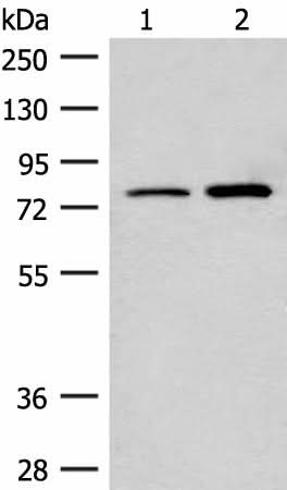 Western blot analysis of Human cerebrum tissue and Human fetal brain tissue lysates using THOP1 Polyclonal Antibody at dilution of 1:250