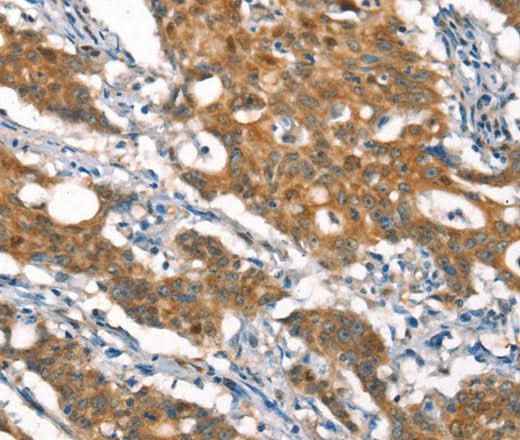 Anti-Human/Mouse/Rat CYLD Antibody
