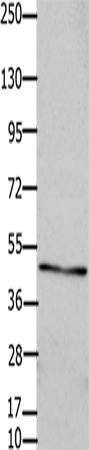 Anti-Human/Mouse/Rat Connexin 47 Antibody - ABMIUM