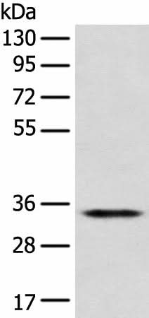 Western blot analysis of Jurkat cell using CD1D Polyclonal Antibody at dilution of 1:300