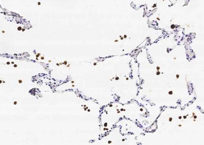 Anti-Human/Cynomolgus CD68 Antibody [A1151] - ABMIUM