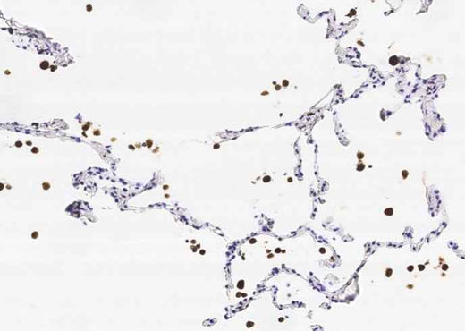 Anti-Human/Cynomolgus CD68 Antibody [A1151] - ABMIUM