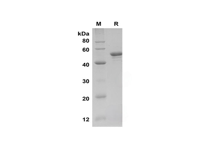 SDS-PAGE analysis of Human HIF-1α proteins, 2 μg/lane of Recombinant Human HIF-1α proteins was resolved with SDS-PAGE under reducing conditions, showing bands at 50 kDa.