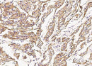 Anti-Human DES Antibody [A1008] - ABMIUM