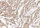 Anti-Human DES Antibody [A1008] - ABMIUM