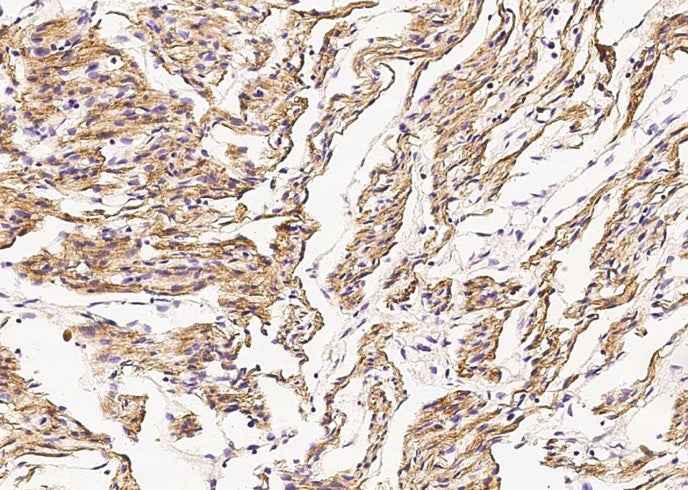 Anti-Human DES Antibody [A1008] - ABMIUM