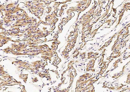 Anti-Human DES Antibody [A1008] - ABMIUM
