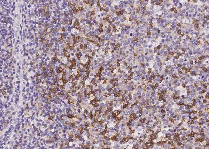 Anti-Human PDCD1 Antibody [A1026] - ABMIUM
