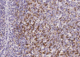 Anti-Human PDCD1 Antibody [A1026] - ABMIUM