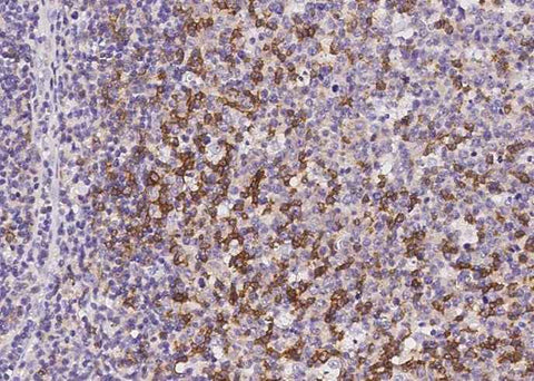 Anti-Human PDCD1 Antibody [A1026] - ABMIUM