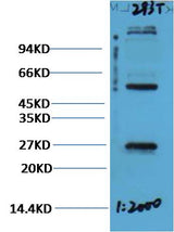 EFHD1 Rabbit pAb 50µL/100µL