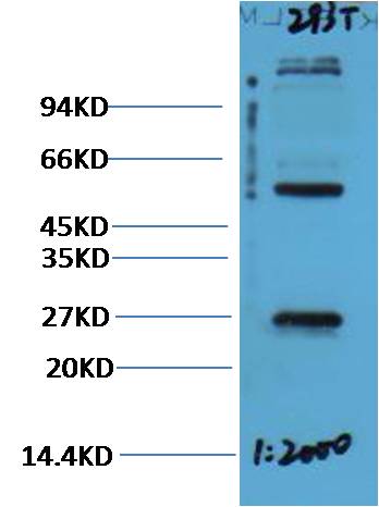 EFHD1 Rabbit pAb 50µL/100µL
