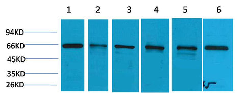 AMPK α1 Rabbit pAb 50µL/100µL