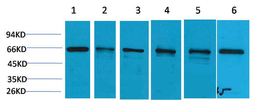 AMPK α1 Rabbit pAb 50µL/100µL