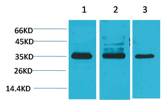 Cav γ4 Rabbit pAb 50µL/100µL