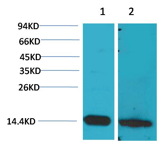 S100 β Rabbit pAb 50µL/100µL