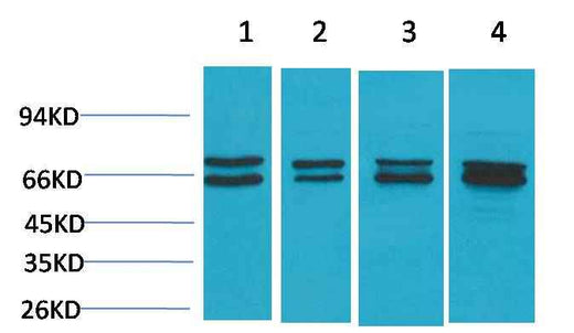 Estrogen Receptor α Rabbit pAb
