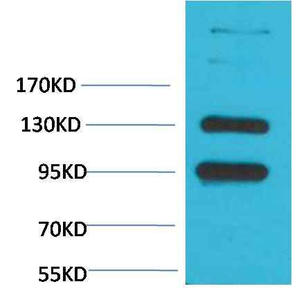 CaVα2δ1 Rabbit pAb