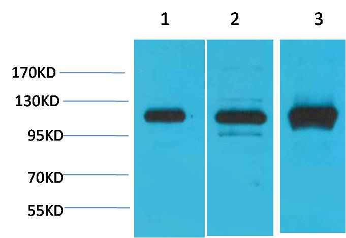 CaVα2δ2 Rabbit pAb