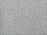 Cav2.2 Rabbit pAb 50µL/100µL