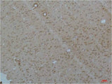 Cav pan α1 Rabbit pAb