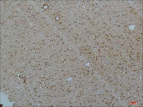 Cav pan α1 Rabbit pAb