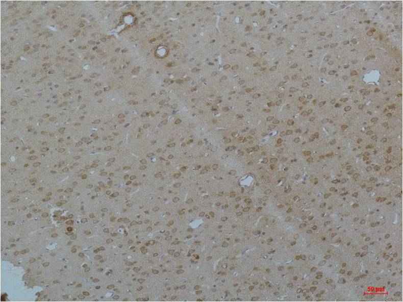 Cav pan α1 Rabbit pAb