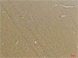 GABA B Receptor 2 Rabbit pAb