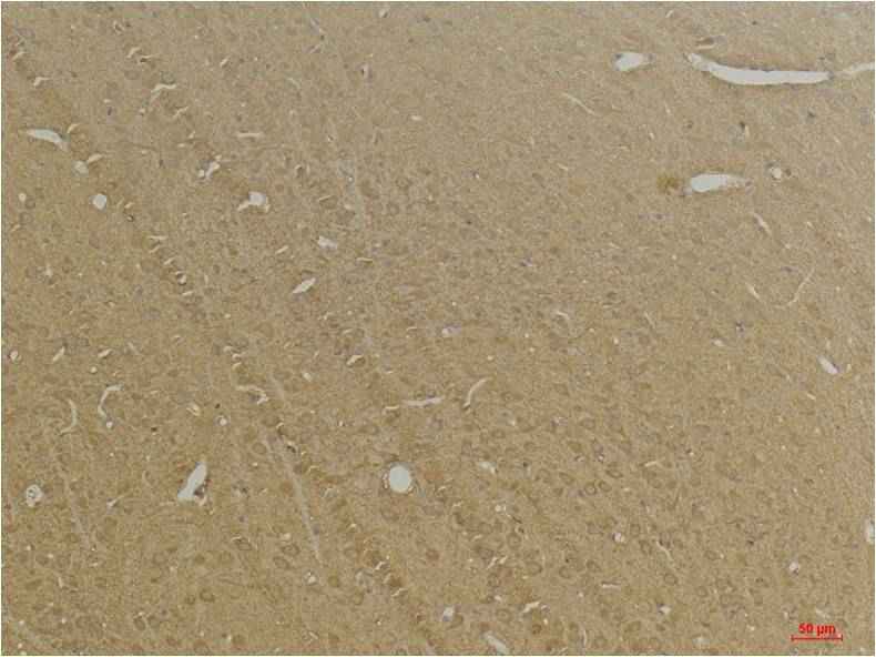 GABA B Receptor 2 Rabbit pAb