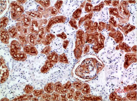 CD10 Rabbit pAb