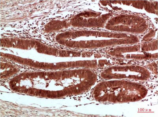 Acetyl-CoA Carboxylase Rabbit pAb