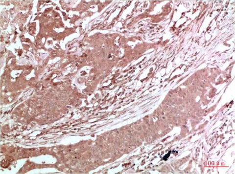 AMPK α2 Rabbit pAb