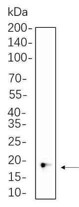 Anti-Human/Mouse/Rat/Sheep 4E-BP1 Antibody [B760]