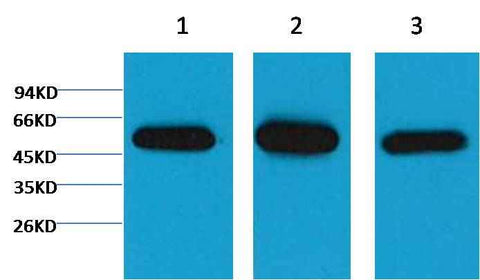 β I tubulin Mouse mAb