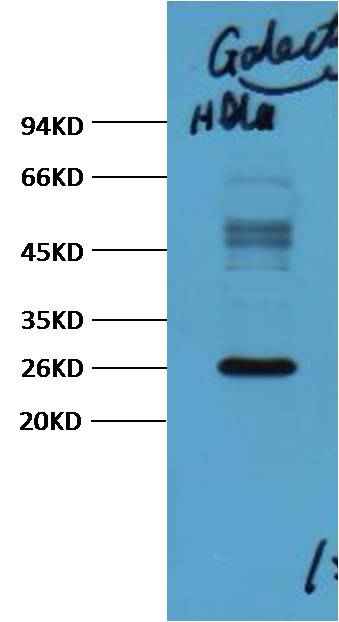 Galectin-3 Mouse mAb