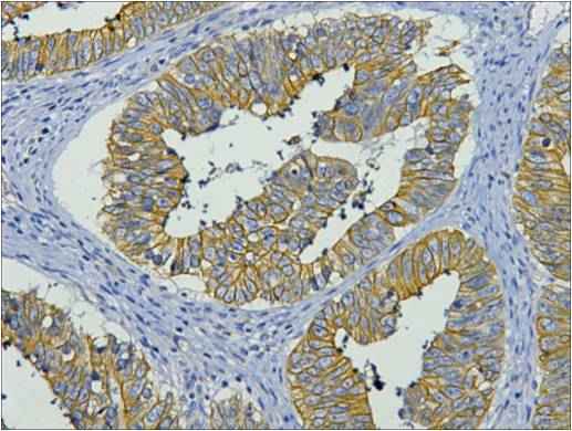 CK19 Mouse mAb
