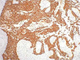 CK16 Mouse mAb