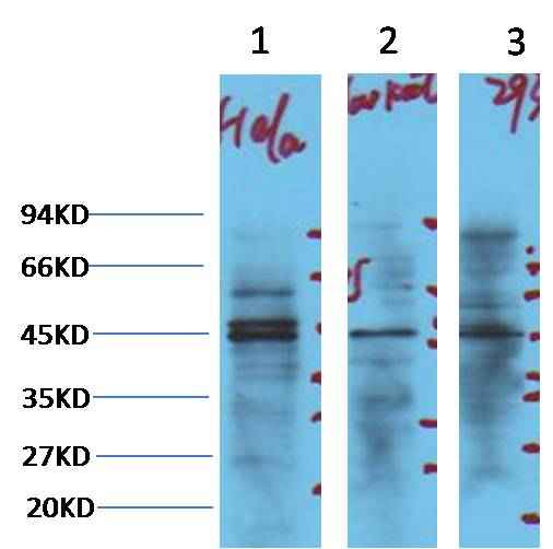 NSE Mouse mAb