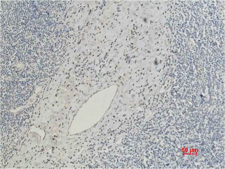 CD5 Mouse mAb
