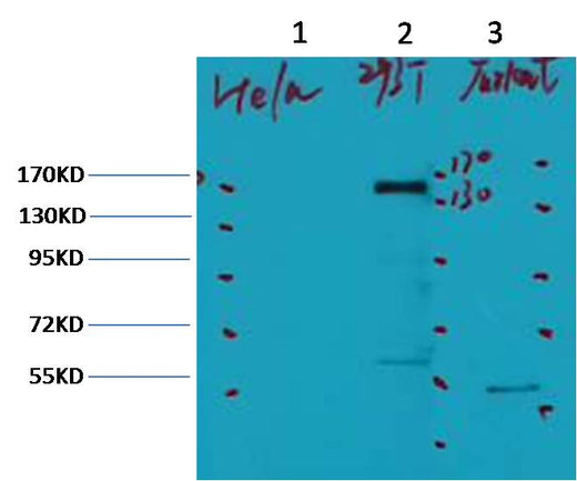 ErbB-2/HER-2 Mouse mAb 50µL/100µL