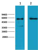 Cytokeratin 6 Mouse mAb