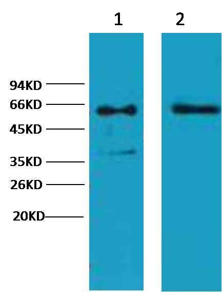 Cytokeratin 6 Mouse mAb