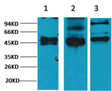 CK17 Mouse mAb
