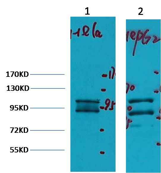 IDE/Insulin Degrading Enzyme Mouse mAb