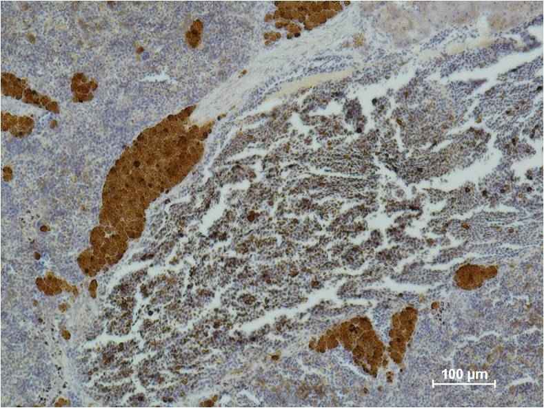 CD25 Mouse mAb
