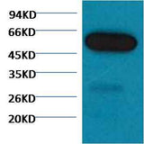 β I tubulin Mouse mAb