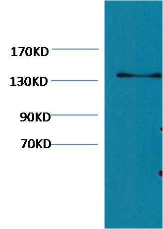 Collagen III Mouse mAb