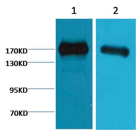 EGFR Mouse mAb