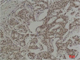 COX2/Cyclooxygenase 2 Mouse mAb